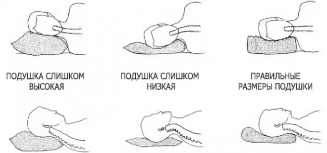 Чи корисно спати без подушки: можна чи ні, користь і шкода