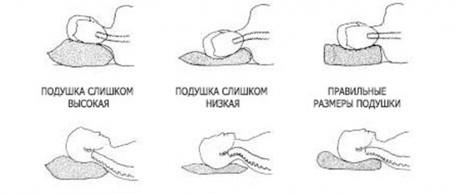 Розміри ортопедичних подушок. Як правильно підібрати ортопедичну подушку за розміром і висоті
